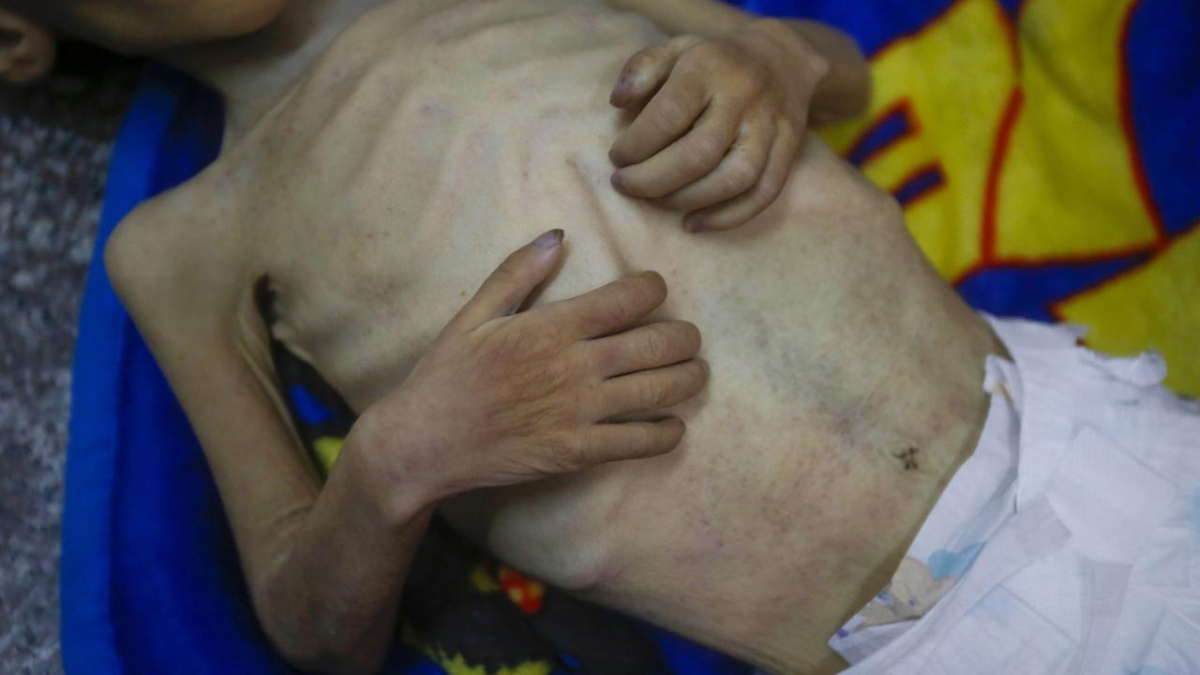 gazzede acliktan olenlerin sayisi artiyor et2M18ft