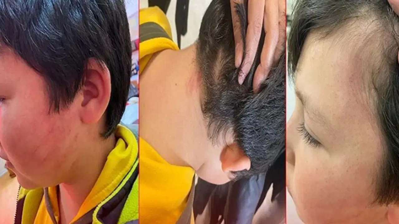 Konya’da Şok Eden Şiddet Olayı: 8 Yaşındaki Çocuk Sınıfta Darp Edildi